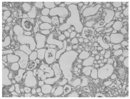 Loạt bài Giới thiệu về tạp chất hoạt tính Folate: ① Tiết lộ tác động của axit 5-Methyltetrahydropteroic.